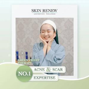 Green Velvet Therapy Trial For Sale Official Site