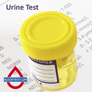 Phosphate Urine Test In London - Order Online - Attend Clinic Cheap Sale Release Dates