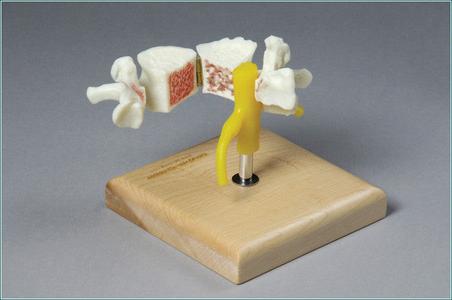 SA24 Vertebra showing Arthritis and Osteoporosis Cheap Sale 2025 Unisex