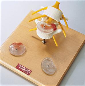 SP68 Premier Lumbar Vertebrae Set exhibits common disc pathologies Buy Cheap Great Deals