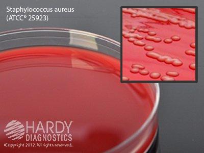 10/BOX, Prepared Media Tryptic Soy Agar (TSA) with 5% Sheep Blood Red Petri Plate Format Free Shipping Low Pice Fee Shipping